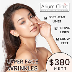 UPPER FACE BOTOX AT $380
